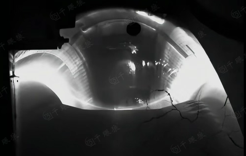 QQ20250528-101400.png